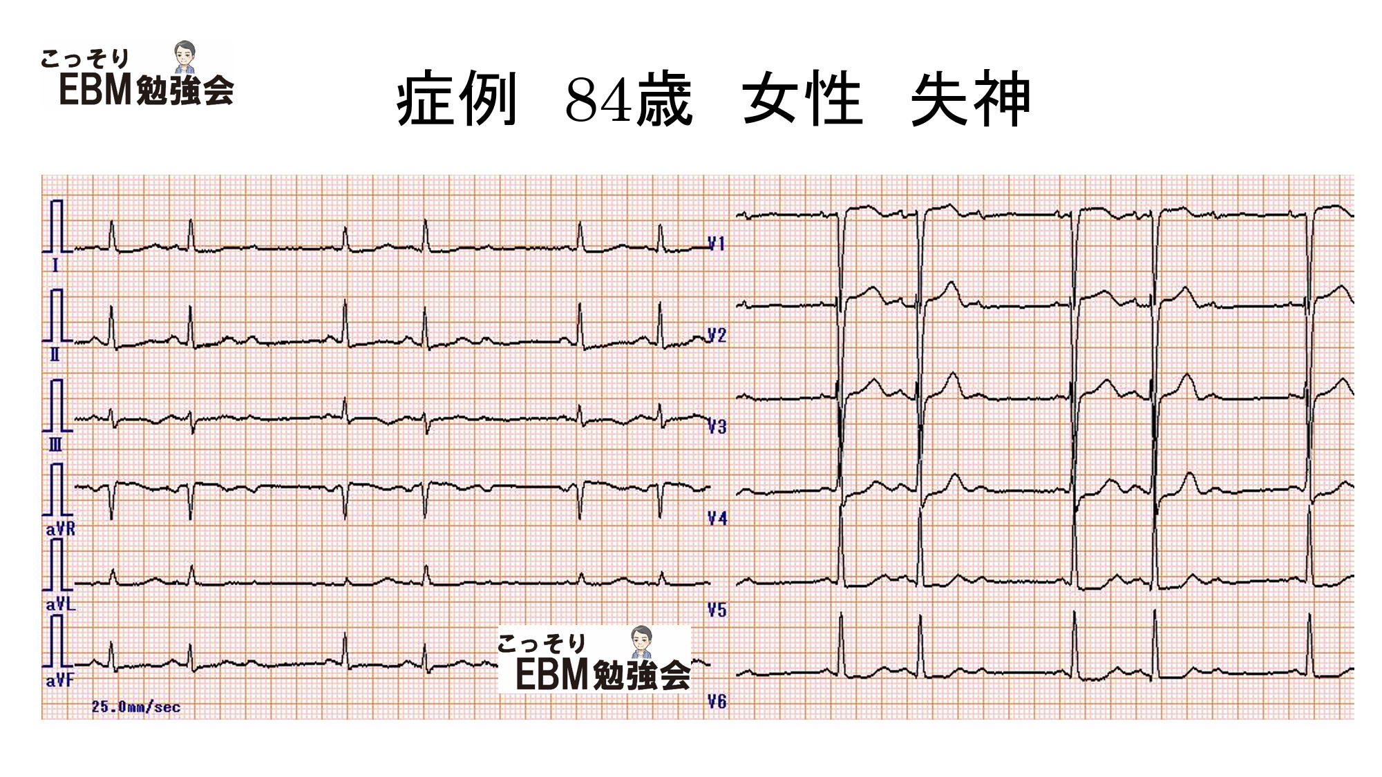 どのようなリスクが伴いますか?