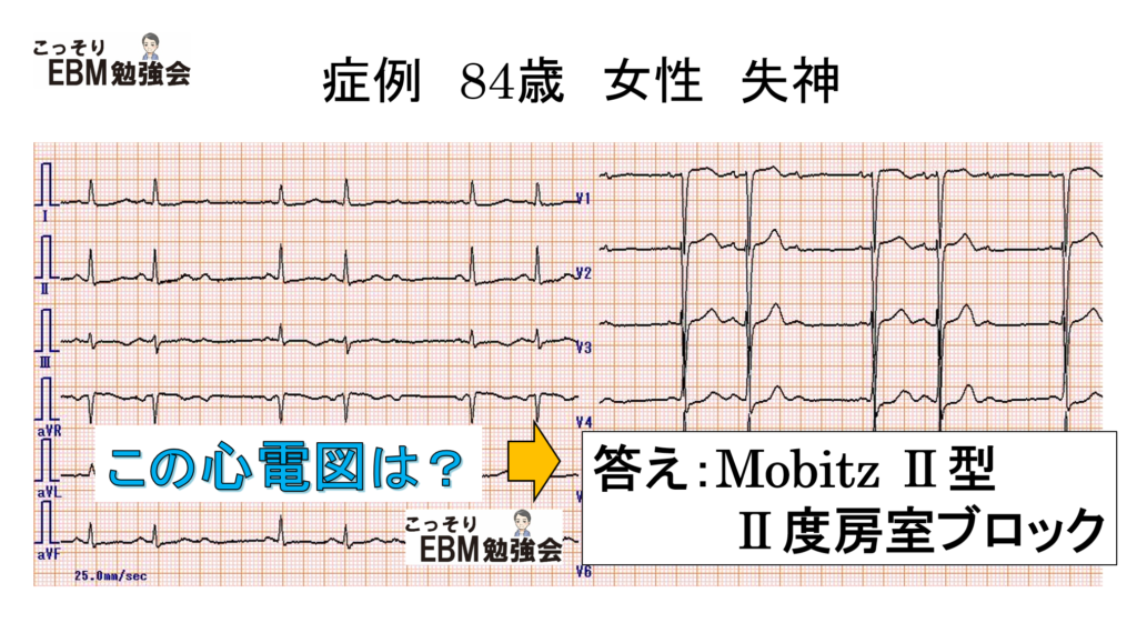 それは何ですか？