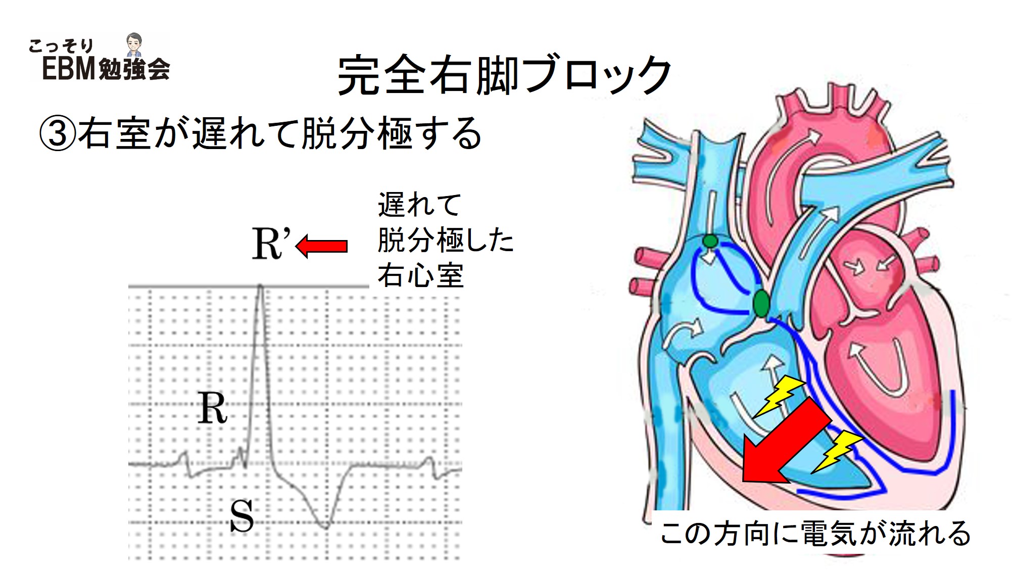 心電図脱分極と再分極: 心電図 仕組み わかりやすく – DHKCJN